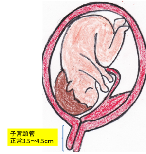 子宮頸管の長さの図